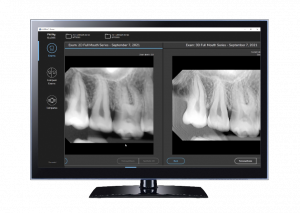 Intraoral tomosynthesis